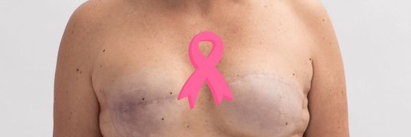 Reconstruction mammaire après cancer : cicatrisation et risques